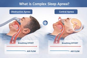 what is complex sleep apnea